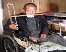 Nhà nghèo, tự cưa chân chữa bệnh