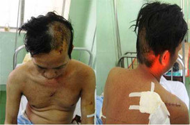 Người đàn ông bị đâm xối xả giữa phố Sài Gòn