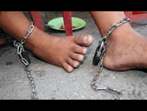 Xót xa chàng trai bị mẹ đốt 'chỗ kín'