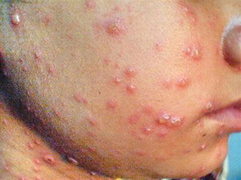 Trả giá đắt để có làn da trắng