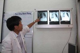 Thợ săn bị hàng chục viên đạn găm vào ngực