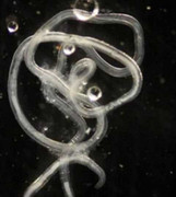 Sán ngọ nguậy trong môi người