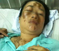 Kẻ tạt axít 'người trong mộng' từng dọa bằng sơn nước