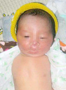 Xót lòng bé trai sơ sinh không có tay chân