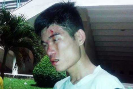 Fan SLNA bị hành hung dã man gửi đơn tới Công an Bình Dương