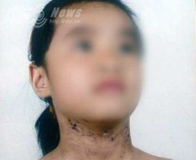 Khởi tố bố đẻ bạo hành con gái dã man ở Hải Dương