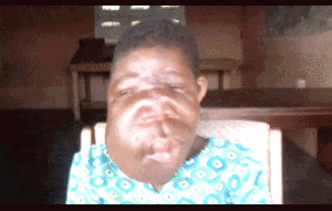 Xót xa bé gái mồ côi có khuôn mặt quỷ