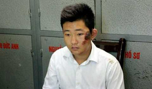 Ném xác phi tang: Bảo vệ Thẩm mỹ viện Cát Tường có bị lừa?