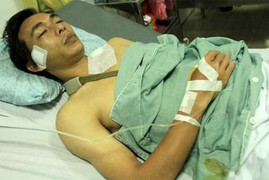 Sao nhà bầu Đức và những tai nạn 'rợn tóc gáy'