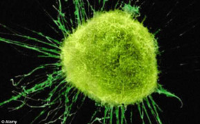 Phương pháp lạ chẩn đoán ung thư trong 10 phút