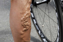 Bệnh lạ xuất hiện trên cơ thể đàn ông