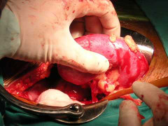 Bí mật thị trường buôn bán nội tạng