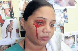 Thiếu nữ khóc ra máu