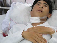 Lý giải bệnh lạ gây chảy máu ồ ạt ở Bắc Giang