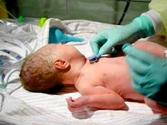 Sản phụ trẻ cùng lúc mang bầu 10 thai nhi