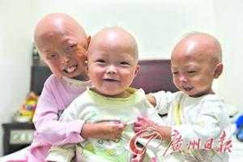 3 cô bé già nhanh hơn người bình thường 5.000 lần