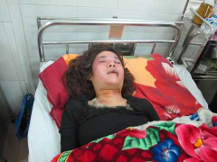 Thiếu nữ xinh đẹp bị tấn công khi đang ngủ