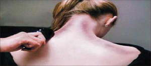 Cô gái tử vong sau khi được bạn trai cạo gió