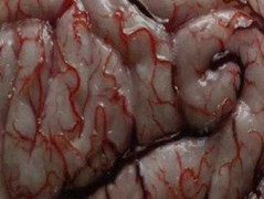 Xem xong hình ảnh này, bạn còn dám hút thuốc lá?