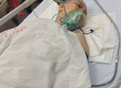 Người bị cắt chân ở Xanh Pôn: Tính mạng nguy kịch