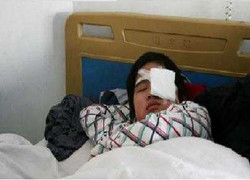 Giáo viên xúi học trò tát bạn mù mắt