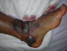 Rộ tin đồn thả rắn lục đuôi đỏ cắn người