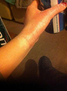 Tin sáng: Biến nước sôi thành tuyết, 50 người bị bỏng