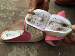 Lý giải hiện tượng ngứa rát, tê chân khi đi dép TQ