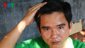 Thiếu úy công an bị tố dùng tô bún đánh cấp dưới nhập viện