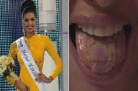 Bí quyết giữ dáng phát sợ của người mẫu tuổi teen