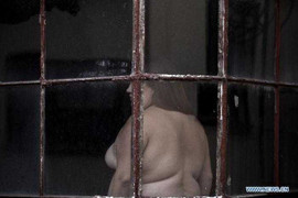 Cô gái trẻ liều lĩnh khoe cơ thể đặc biệt