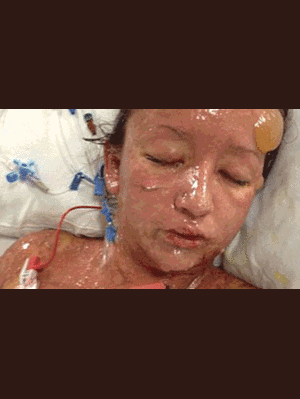 Thiếu nữ xinh đẹp lở loét toàn thân