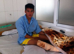 Đá gãy chân đối phương: Thủ phạm suy sụp, nạn nhân thương cảm