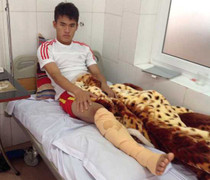 Đạp gãy chân đối thủ: Thủ phạm, nạn nhân đều đáng thương