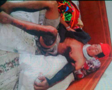 Điện cao thế giật cháy sém dân: Điện lực phân bua