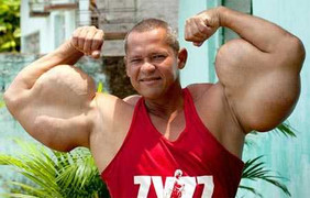 Rộ mốt tiêm thuốc độc tạo bắp tay 'khủng'