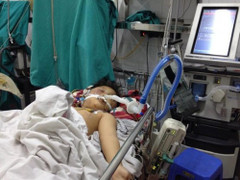 Bé bị bố đánh chấn thương sọ não, khó qua khỏi