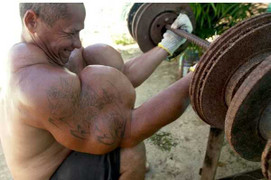 Cận cảnh tiêm cồn vào cơ thể để có bắp tay cuồn cuộn