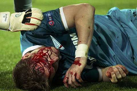 Máu tiếp tục đổ ở Champions League