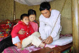 Cô bé 'ma cà rồng' và sở thích ăn thịt sống