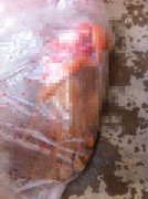 Sự thật bàn chân người dính máu trên xe khách