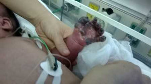 Gia đình mang xác cháu bé bị hoại tử tay về quê an táng