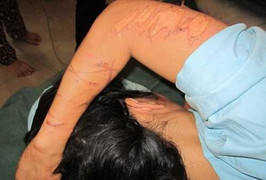 Khởi tố 3 kẻ nhốt, tra tấn phụ nữ như thời trung cổ