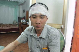 Một giám đốc bị nhóm côn đồ truy sát lúc chập tối