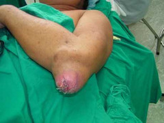 Bệnh hành hạ quý ông làm suy giảm 