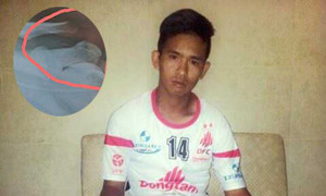 Xót lòng cầu thủ Việt phải tách gân chân nối lên vai