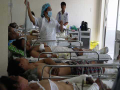 Lời kể kinh hoàng vụ nổ lò thép khiến 12 người bỏng nặng