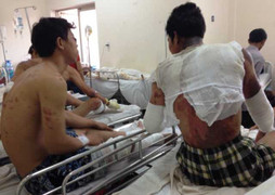 Nổ lò nung thép: Nhiều công nhân không mang bảo hộ lao động