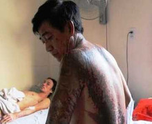 Kinh hoàng người đàn ông bị tạt axít giữa phố