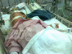 Sự thật hơn 100 trẻ tử vong do sởi